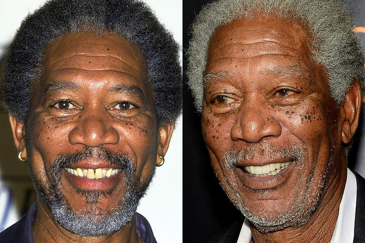 25 celebrities who (thankfully) have had dental work