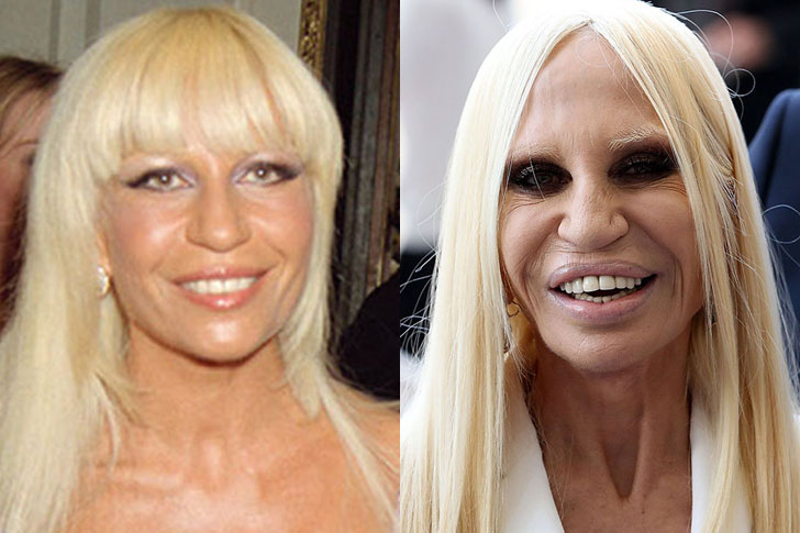 The 20 most shocking celebrity plastic surgery disasters of all time ...